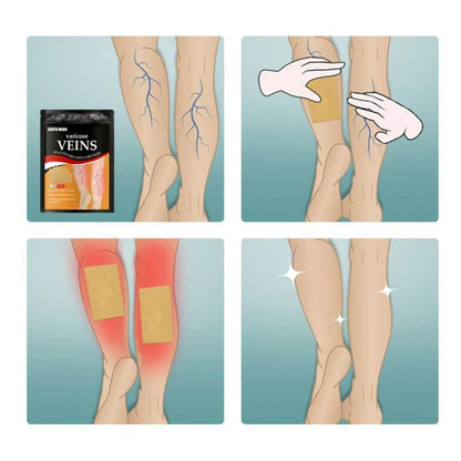 VeniPatch® - Parche Para Varices